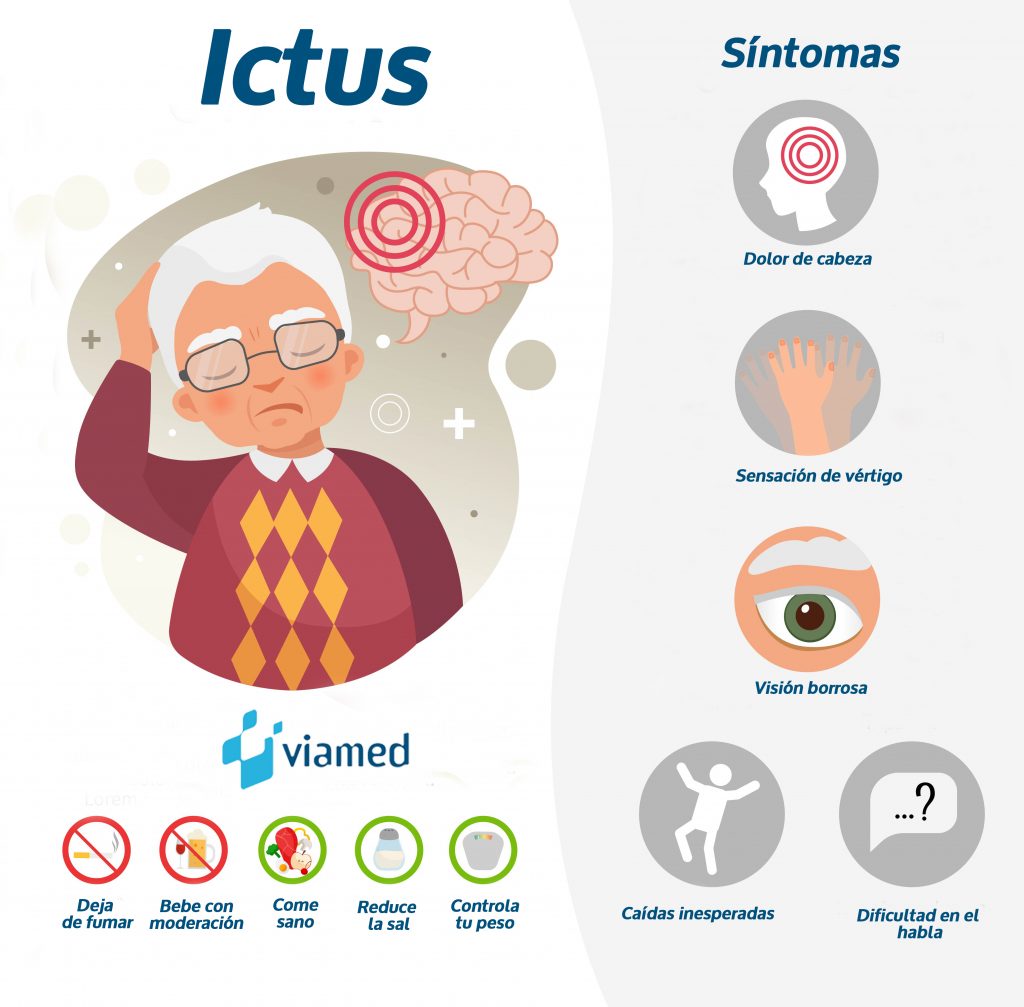 ¿Qué es un ictus?