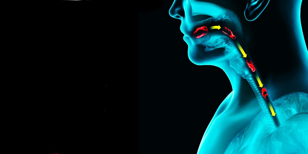 8 patologías que provocan hernia de hiato