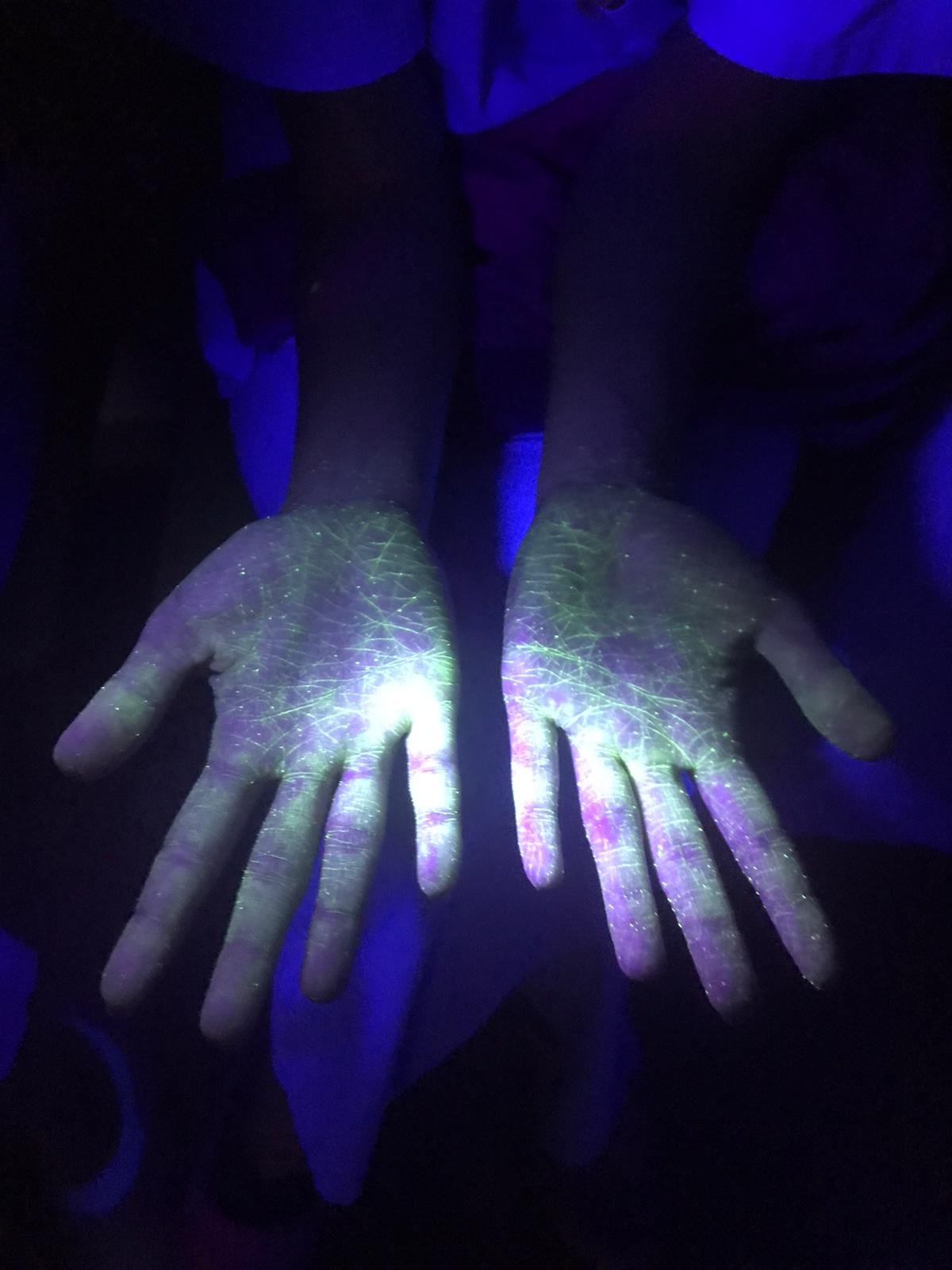 Viamed implementa un proyecto de mejora para comprobar la correcta higiene de manos