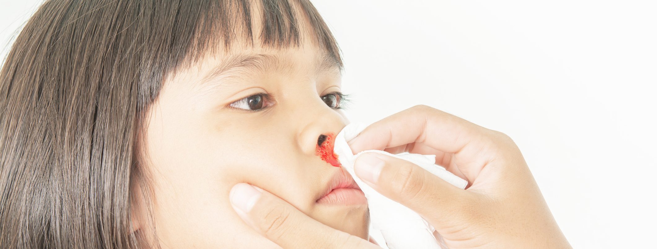 ¿Qué podemos hacer ante una hemorragia nasal?
