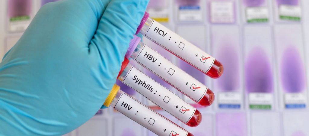 Enfermedades de transmisión sexual