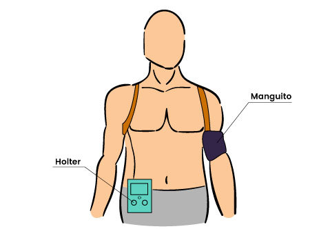 Que Significa Mapa En Cardiologia Infoupdate