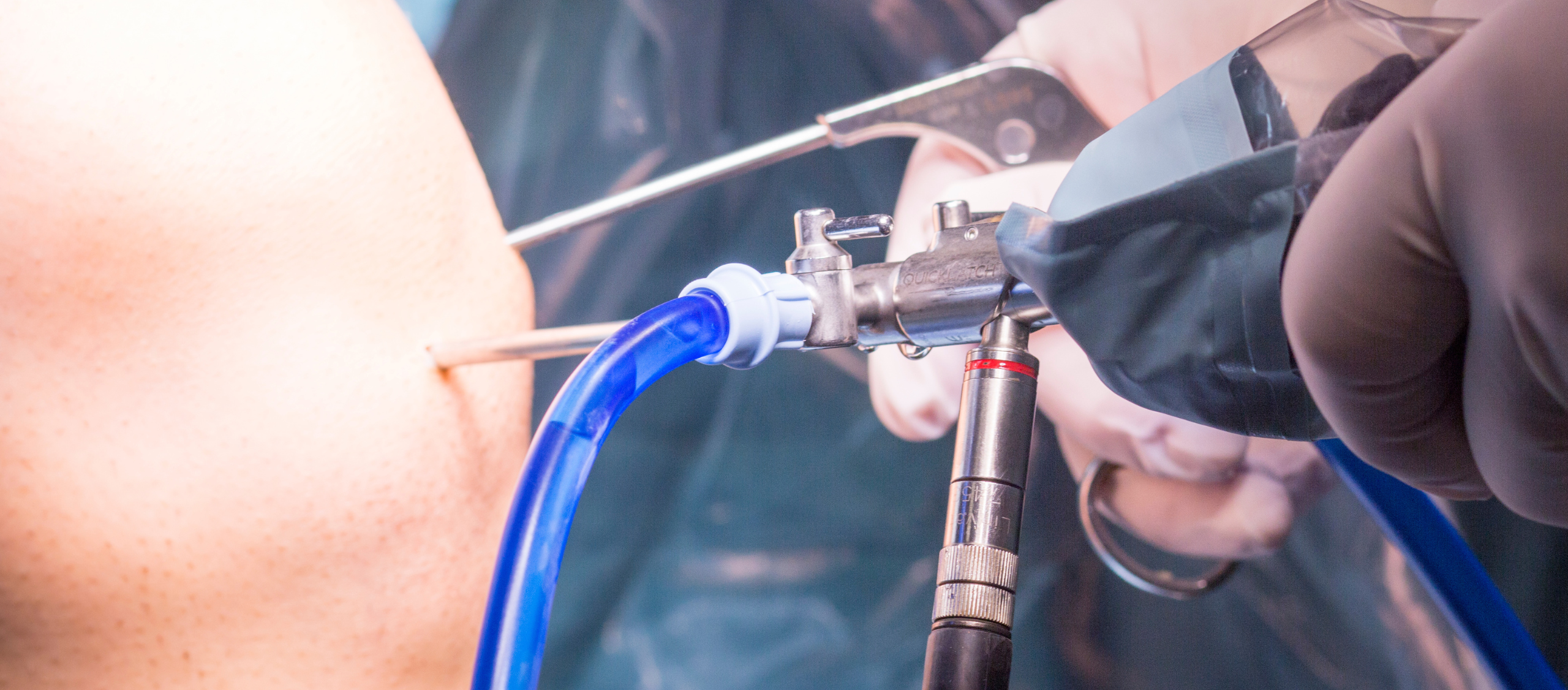 Operación de Menisco por Artroscopia