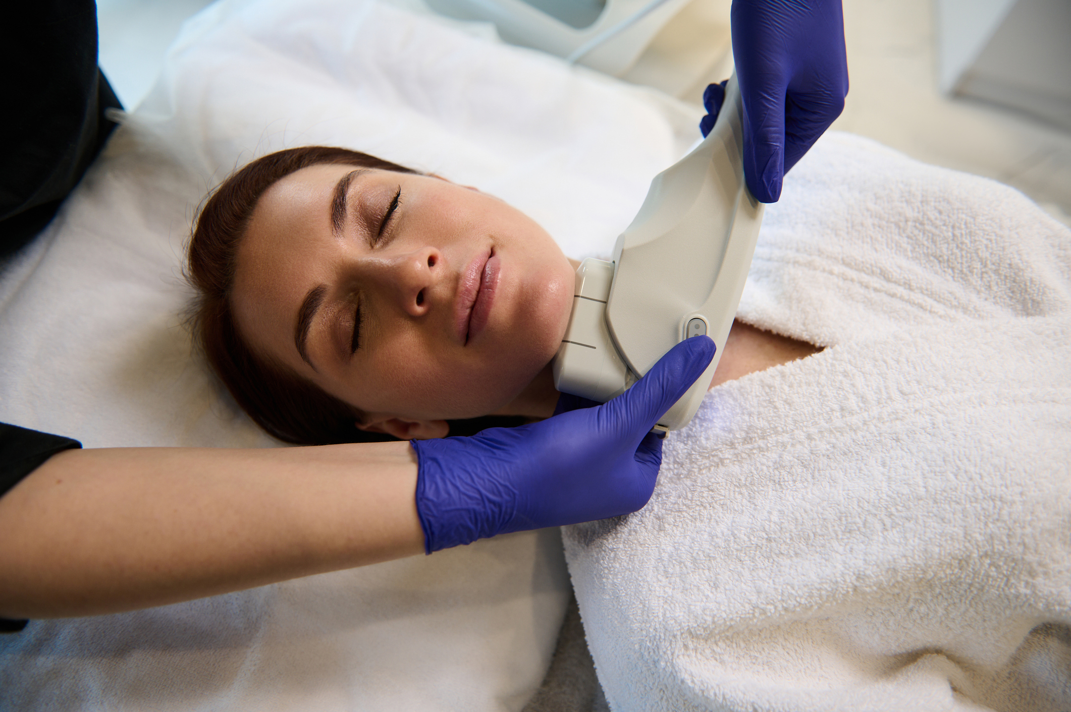 Láser CO2 Dermatológico